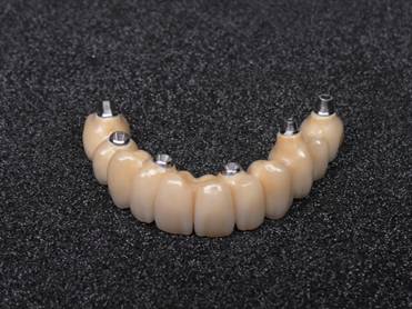 interdental_Cad_Cam_protezy_dentures_Prothesen_CoCr__ARTEX_GIRBACH_CONDYLATOR-6s.jpeg